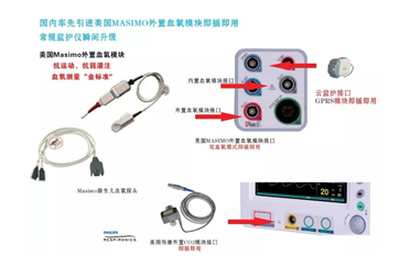 新生兒監護-如何才能有效的預防新生兒心臟病的發生！